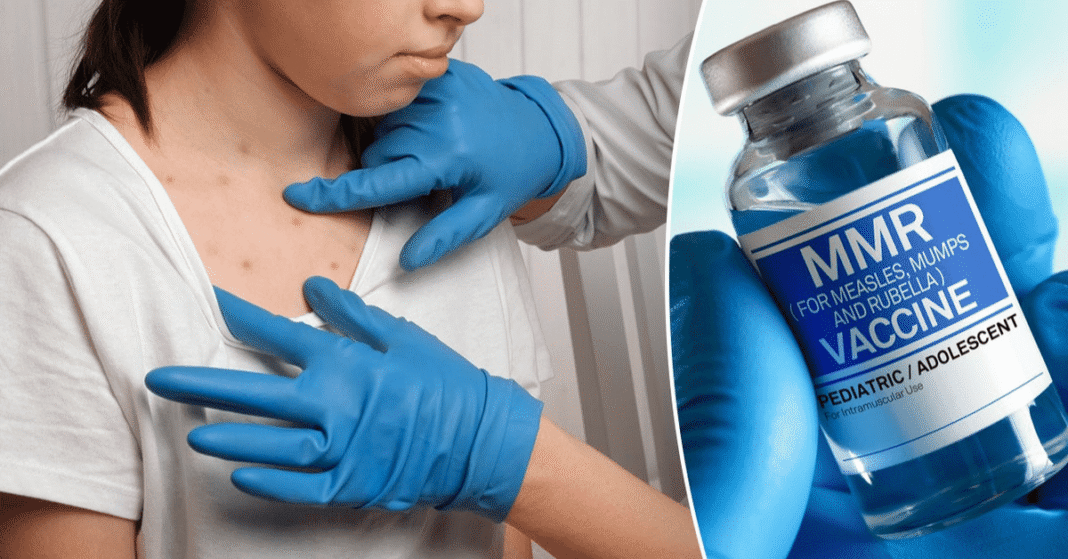 Measles outbreak UK: MMR vaccine vial and syringe during immunisation campaign